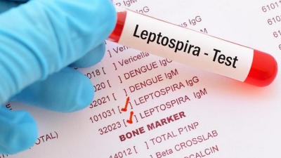 Deratizacija i Leptospiroza